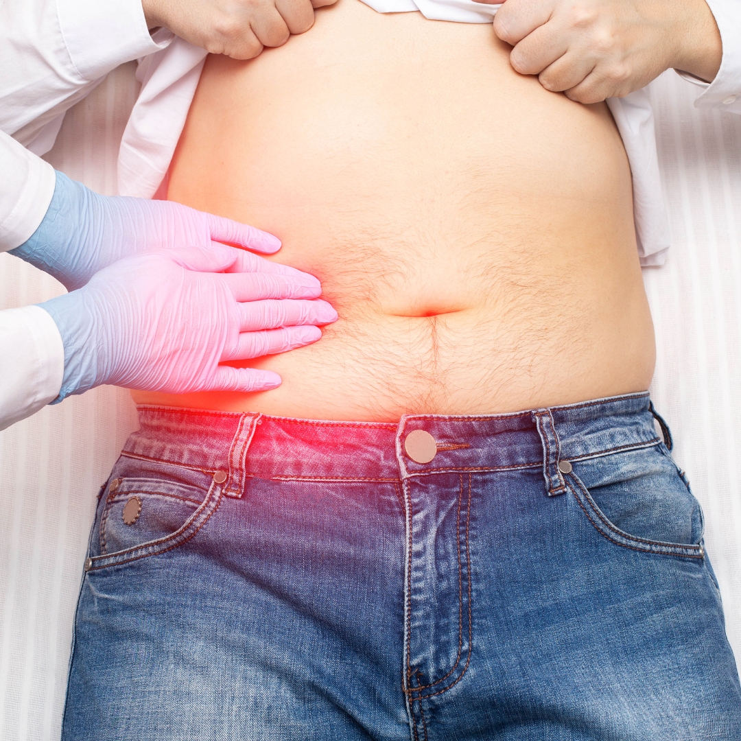 Gallbladder disorders & gallstones